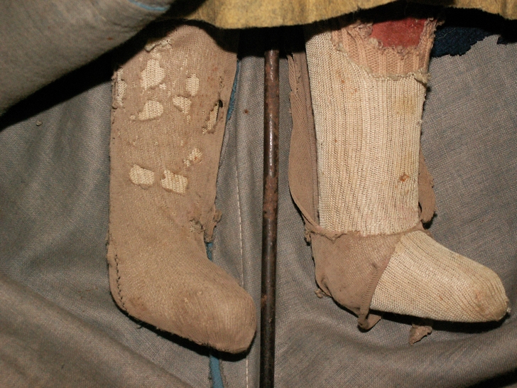 Calze prima del restauro-fronte